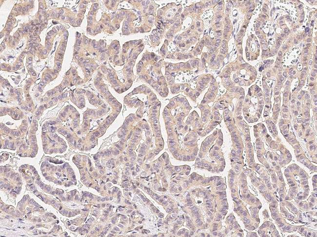 METAP2 Antibody in Immunohistochemistry (Paraffin) (IHC (P))