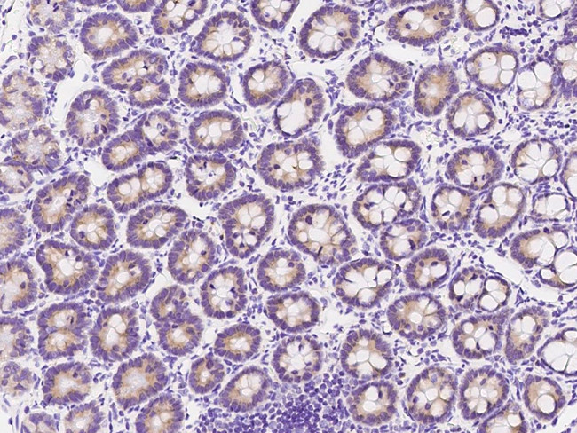 METAP2 Antibody in Immunohistochemistry (Paraffin) (IHC (P))