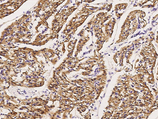 GLUT4 Antibody in Immunohistochemistry (Paraffin) (IHC (P))