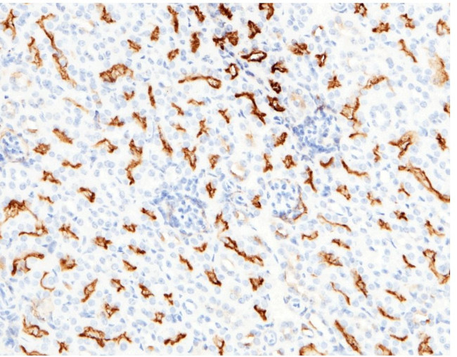 CD13 Antibody in Immunohistochemistry (Paraffin) (IHC (P))