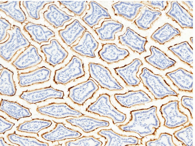 CD13 Antibody in Immunohistochemistry (Paraffin) (IHC (P))