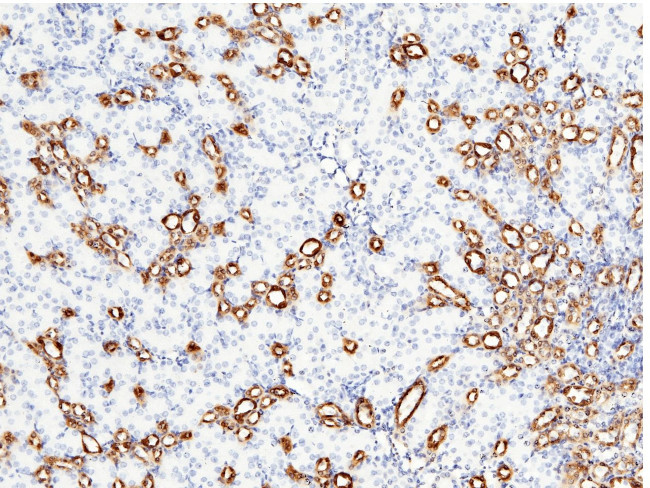 Carbonic Anhydrase II Antibody in Immunohistochemistry (Paraffin) (IHC (P))