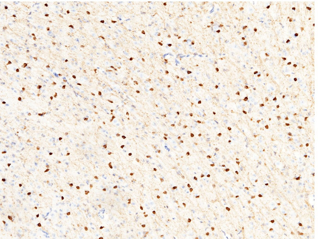 Carbonic Anhydrase II Antibody in Immunohistochemistry (Paraffin) (IHC (P))