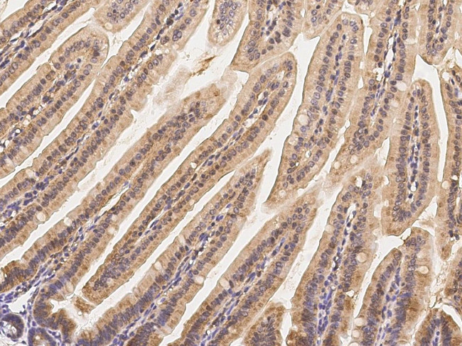 MCP-2 Antibody in Immunohistochemistry (Paraffin) (IHC (P))