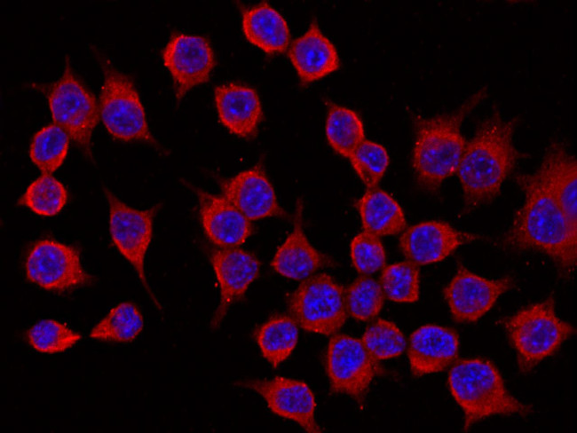 CHIL3 Antibody in Immunocytochemistry (ICC/IF)