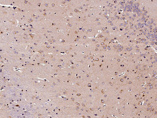 CNDP1 Antibody in Immunohistochemistry (Paraffin) (IHC (P))