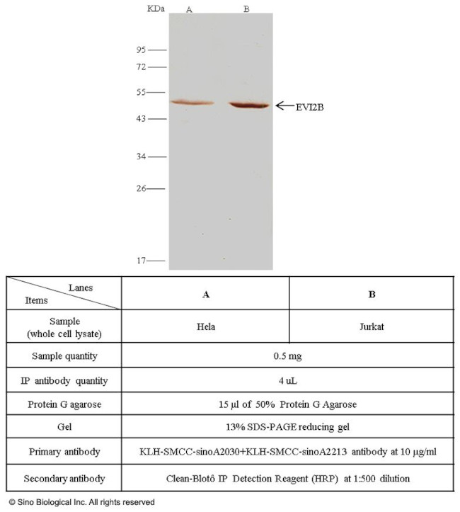 EVI2B Antibody in Immunoprecipitation (IP)