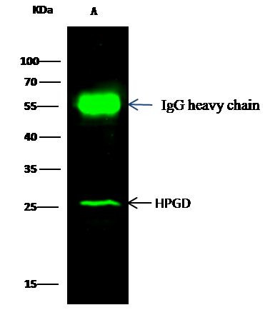 15-PGDH Antibody in Immunoprecipitation (IP)