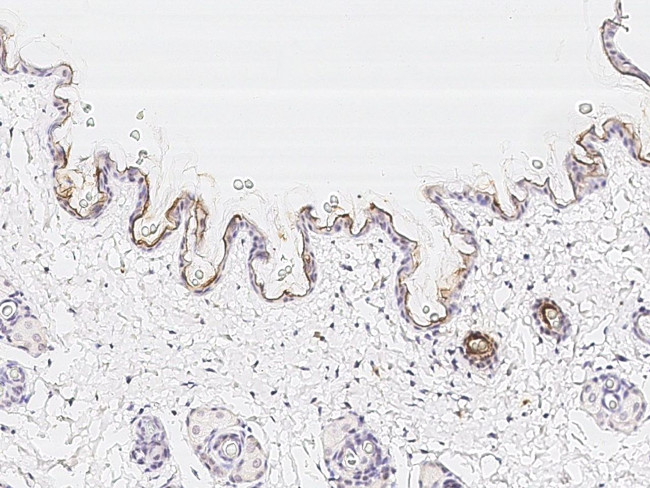 ITGA3 Antibody in Immunohistochemistry (Paraffin) (IHC (P))