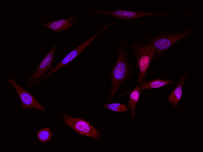 MEK6 Antibody in Immunocytochemistry (ICC/IF)