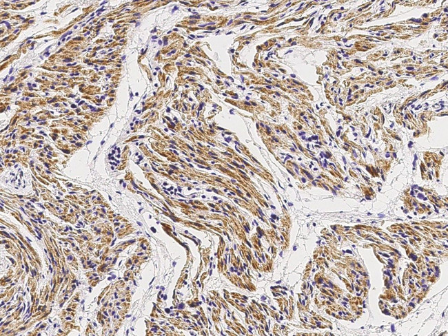 MEK6 Antibody in Immunohistochemistry (Paraffin) (IHC (P))