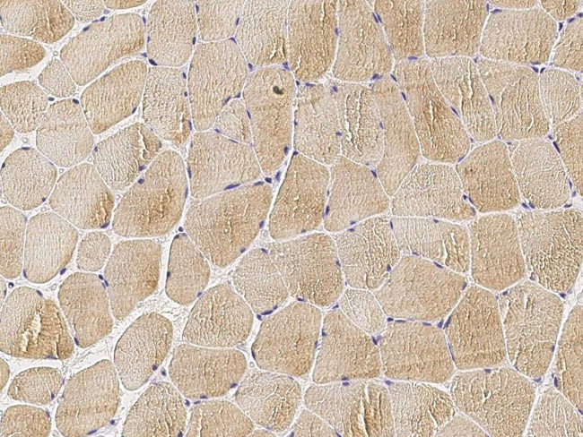 MEK6 Antibody in Immunohistochemistry (Paraffin) (IHC (P))