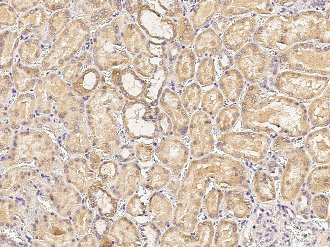 PIK3CG Antibody in Immunohistochemistry (Paraffin) (IHC (P))