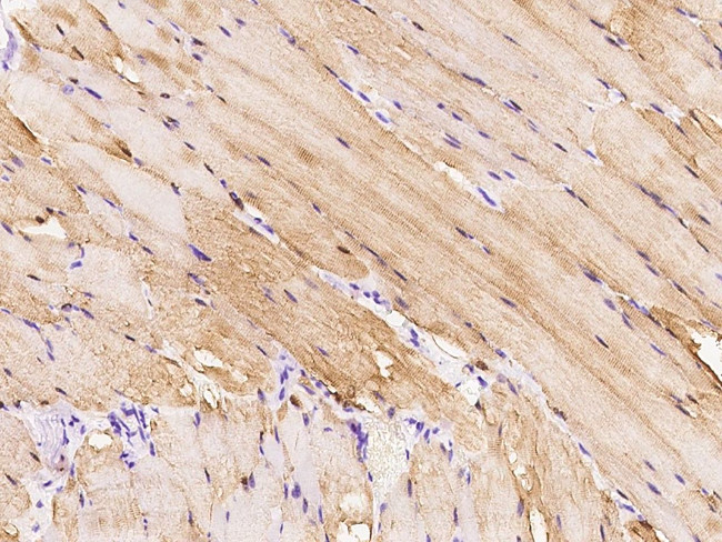 PIK3CG Antibody in Immunohistochemistry (Paraffin) (IHC (P))