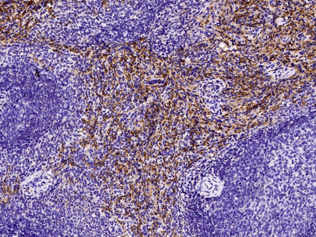 CD16/CD32 Antibody in Immunohistochemistry (Paraffin) (IHC (P))