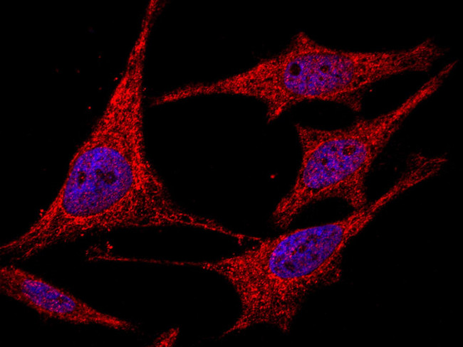 GP130 Antibody in Immunocytochemistry (ICC/IF)