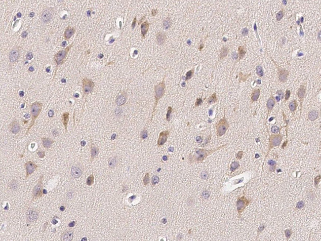 GP130 Antibody in Immunohistochemistry (Paraffin) (IHC (P))