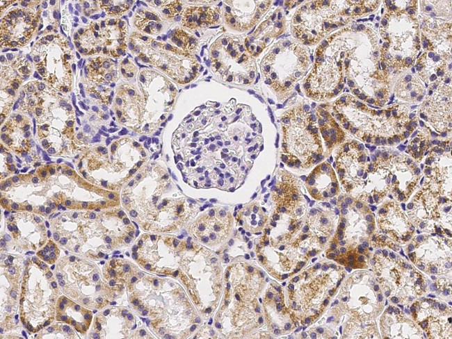 GP130 Antibody in Immunohistochemistry (Paraffin) (IHC (P))