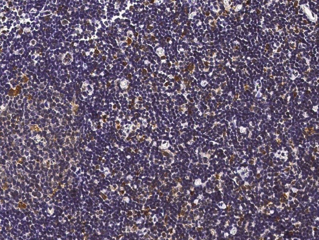 IFNA5 Antibody in Immunohistochemistry (Paraffin) (IHC (P))