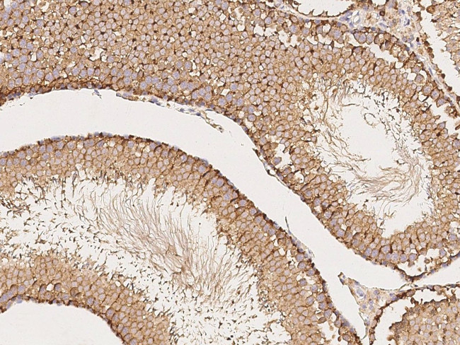 NPC2 Antibody in Immunohistochemistry (Paraffin) (IHC (P))