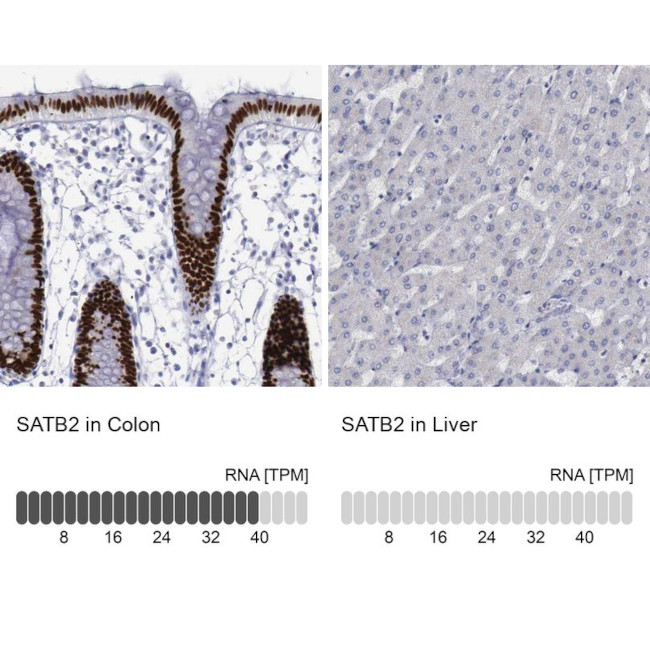 SATB2 Antibody