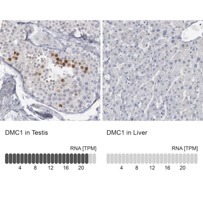 DMC1 Antibody