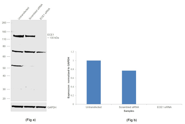 ECE1 Antibody in Western Blot (WB)