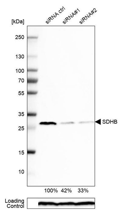 SDHB Antibody