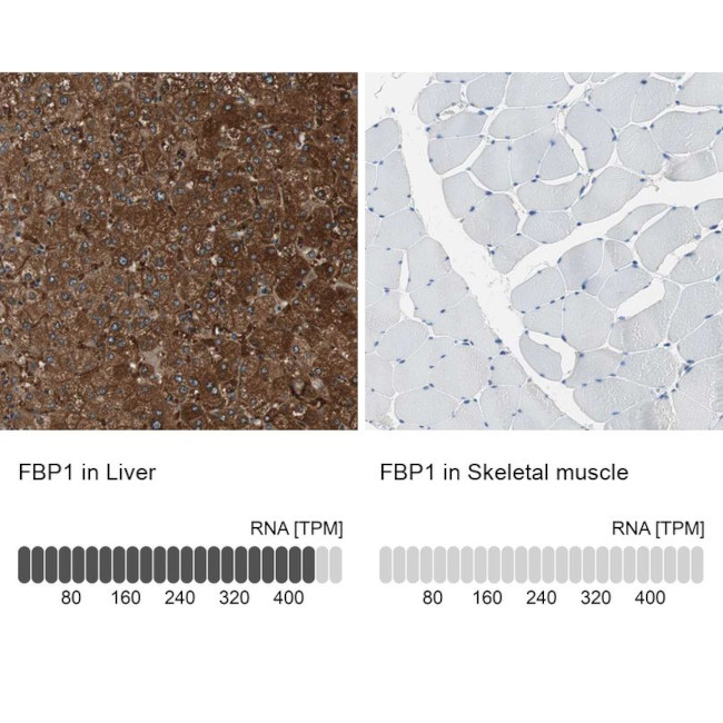 FBP1 Antibody