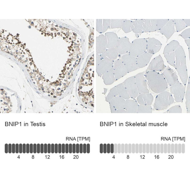 BNIP1 Antibody