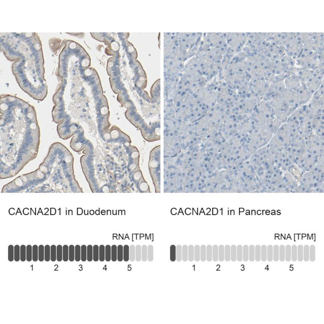 CACNA2D1 Antibody