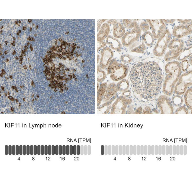 KIF11 Antibody