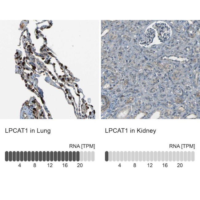 LPCAT1 Antibody