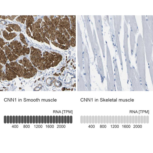 Calponin 1 Antibody