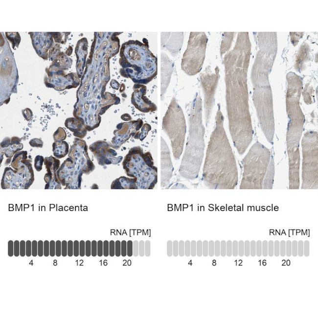 BMP1 Antibody