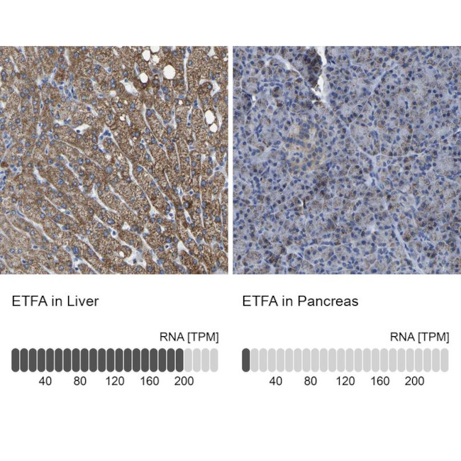 ETFA Antibody