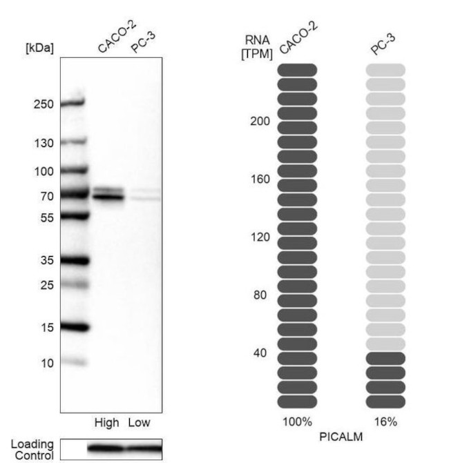 CALM Antibody