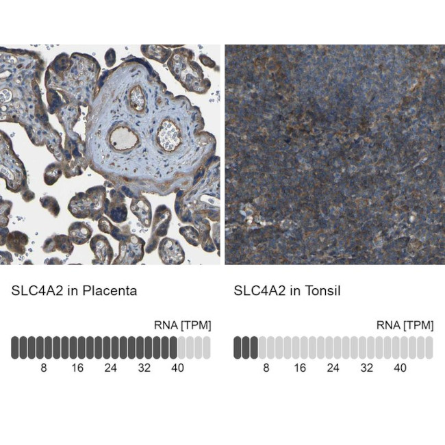 SLC4A2 Antibody