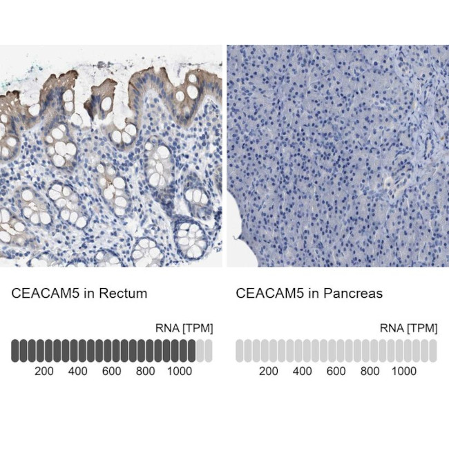 CEA Antibody