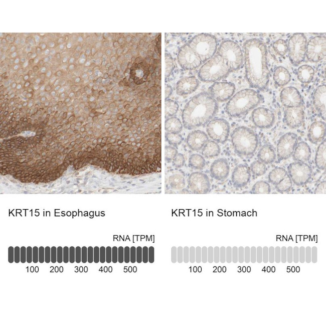 Cytokeratin 15 Antibody