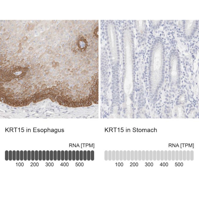 Cytokeratin 15 Antibody