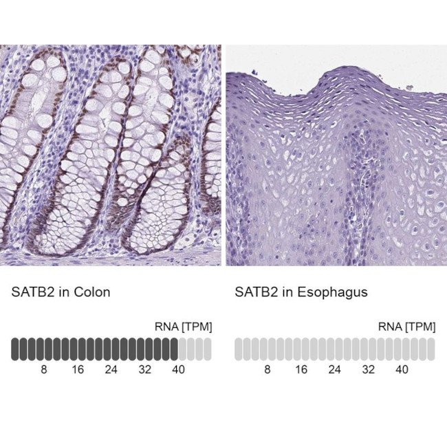 SATB2 Antibody