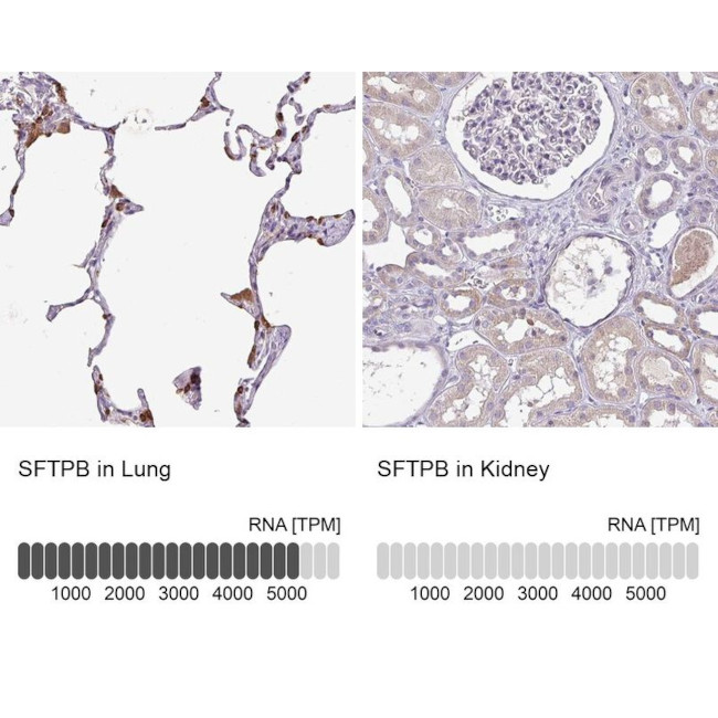 SFTPB Antibody