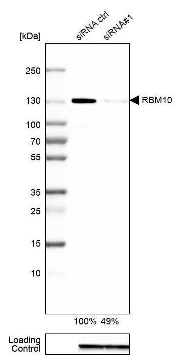 RBM10 Antibody