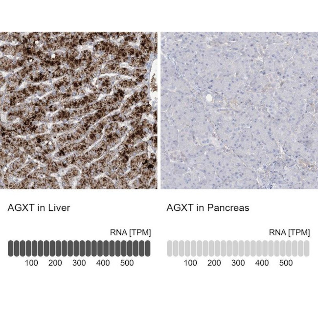 AGXT Antibody