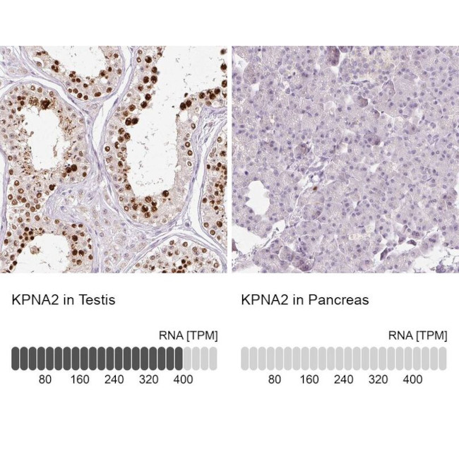 KPNA2 Antibody