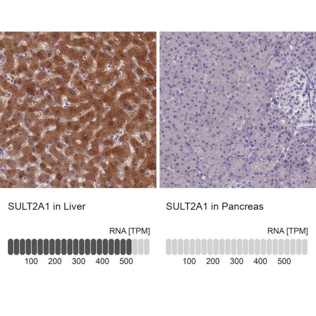 SULT2A1 Antibody