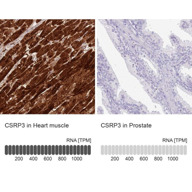 CSRP3 Antibody