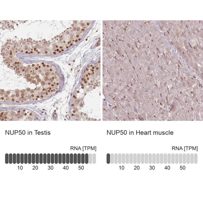 NUP50 Antibody