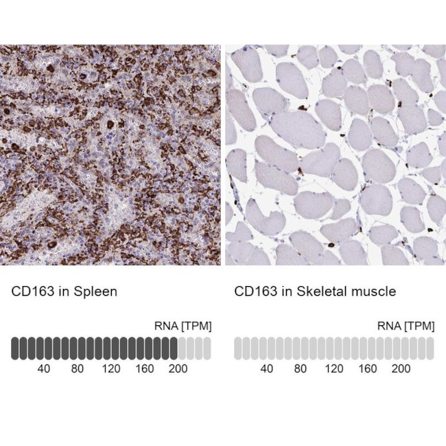 CD163 Antibody